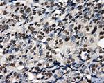 PSMC3 Antibody in Immunohistochemistry (Paraffin) (IHC (P))