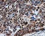 PSMC3 Antibody in Immunohistochemistry (Paraffin) (IHC (P))