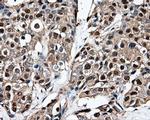 PSMC3 Antibody in Immunohistochemistry (Paraffin) (IHC (P))