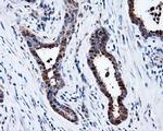 PSMC3 Antibody in Immunohistochemistry (Paraffin) (IHC (P))