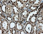 PSMC3 Antibody in Immunohistochemistry (Paraffin) (IHC (P))