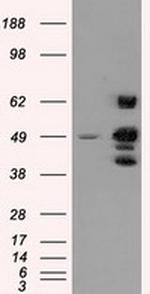 PSMC3 Antibody in Western Blot (WB)