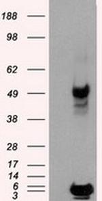 PSMC3 Antibody in Western Blot (WB)