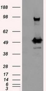 PSMC3 Antibody in Western Blot (WB)