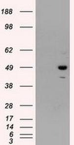 PSMC3 Antibody in Western Blot (WB)