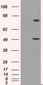 PSMC3 Antibody in Western Blot (WB)