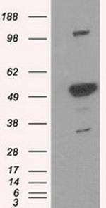 PSMC3 Antibody in Western Blot (WB)