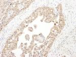 PSMC4 Antibody in Immunohistochemistry (IHC)