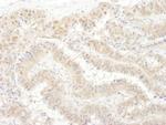 PSMC4 Antibody in Immunohistochemistry (IHC)