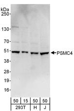 PSMC4 Antibody in Western Blot (WB)