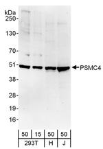 PSMC4 Antibody in Western Blot (WB)