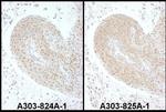 PSMC6 Antibody in Immunohistochemistry (IHC)