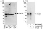 PSMC6 Antibody in Western Blot (WB)