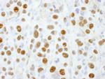 PSMD1 Antibody in Immunohistochemistry (IHC)