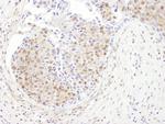 PSMD1 Antibody in Immunohistochemistry (IHC)