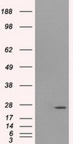 PSMD10 Antibody in Western Blot (WB)