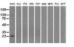 PSMD10 Antibody in Western Blot (WB)