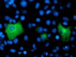 PSMD2 Antibody in Immunocytochemistry (ICC/IF)