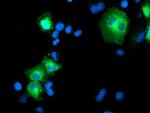 PSMD2 Antibody in Immunocytochemistry (ICC/IF)