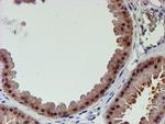 PSMD2 Antibody in Immunohistochemistry (Paraffin) (IHC (P))