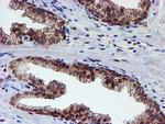 PSMD2 Antibody in Immunohistochemistry (Paraffin) (IHC (P))