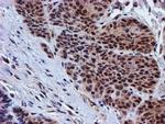 PSMD2 Antibody in Immunohistochemistry (Paraffin) (IHC (P))