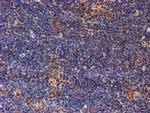 PSMD2 Antibody in Immunohistochemistry (Paraffin) (IHC (P))