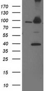 PSMD2 Antibody in Western Blot (WB)