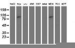 PSMD2 Antibody in Western Blot (WB)