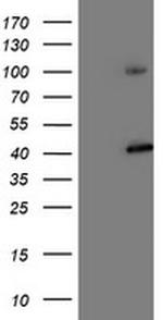 PSMD2 Antibody in Western Blot (WB)