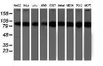 PSMD2 Antibody in Western Blot (WB)