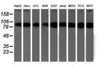 PSMD2 Antibody in Western Blot (WB)