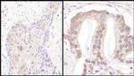 PSMD3 Antibody in Immunohistochemistry (IHC)