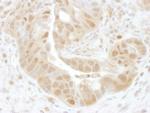 PSMD7 Antibody in Immunohistochemistry (IHC)