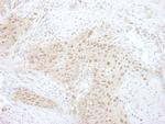 PSMD7 Antibody in Immunohistochemistry (IHC)