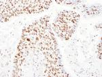 PSME3 Antibody in Immunohistochemistry (IHC)