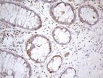 PSMG2 Antibody in Immunohistochemistry (Paraffin) (IHC (P))