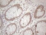 PSMG2 Antibody in Immunohistochemistry (Paraffin) (IHC (P))