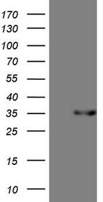 PSMG2 Antibody in Western Blot (WB)