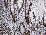 PTBP3 Antibody in Immunohistochemistry (Paraffin) (IHC (P))