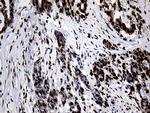 PTBP3 Antibody in Immunohistochemistry (Paraffin) (IHC (P))