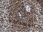 PTBP3 Antibody in Immunohistochemistry (Paraffin) (IHC (P))