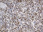 PTBP3 Antibody in Immunohistochemistry (Paraffin) (IHC (P))