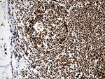 PTBP3 Antibody in Immunohistochemistry (Paraffin) (IHC (P))