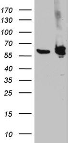 PTBP3 Antibody in Western Blot (WB)