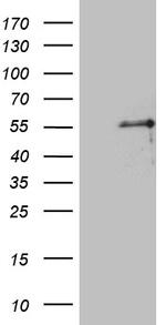 PTF1A Antibody in Western Blot (WB)