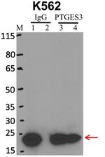 p23 Antibody in Immunoprecipitation (IP)