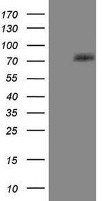 PTGS2 Antibody in Western Blot (WB)