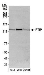 PTIP Antibody in Western Blot (WB)