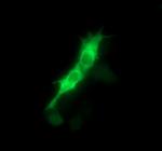 PTK2 Antibody in Immunocytochemistry (ICC/IF)